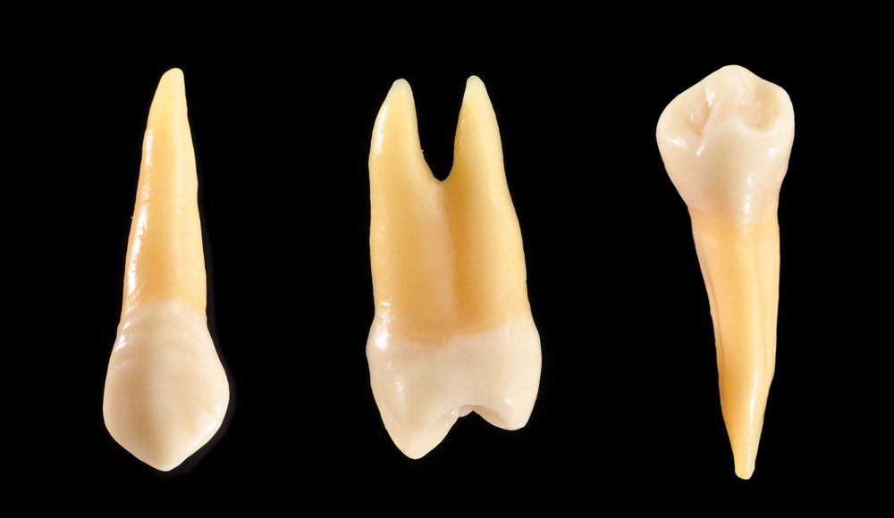 cancer oral test for to maxilla Autotransplantation teeth the of anterior