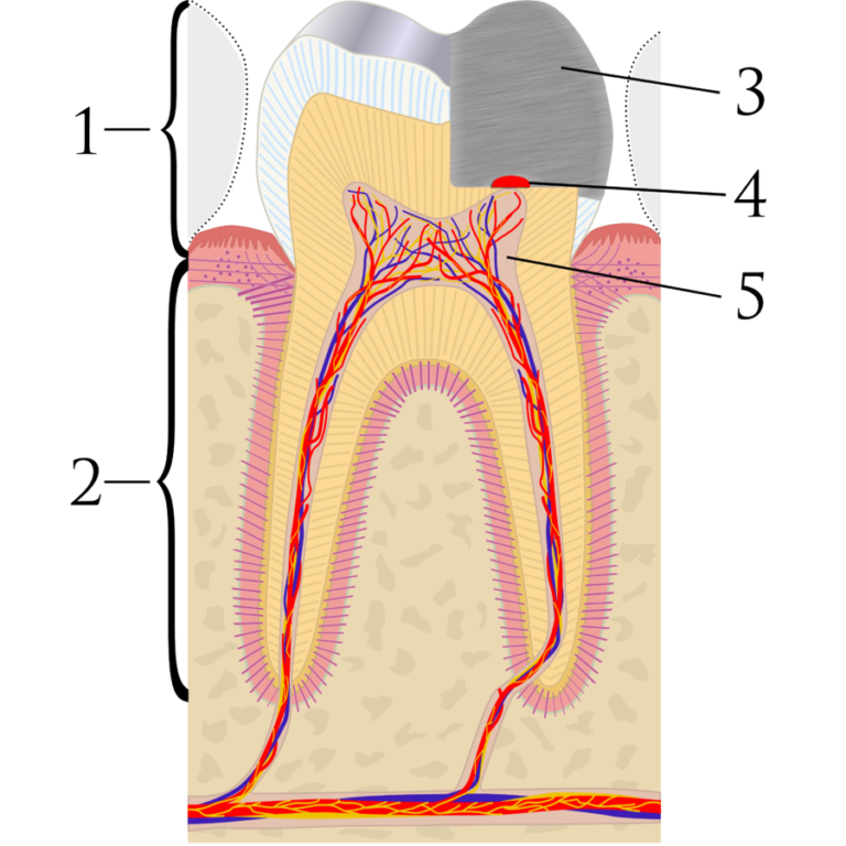 Direct pulp capping in primary teeth - National Elf Service