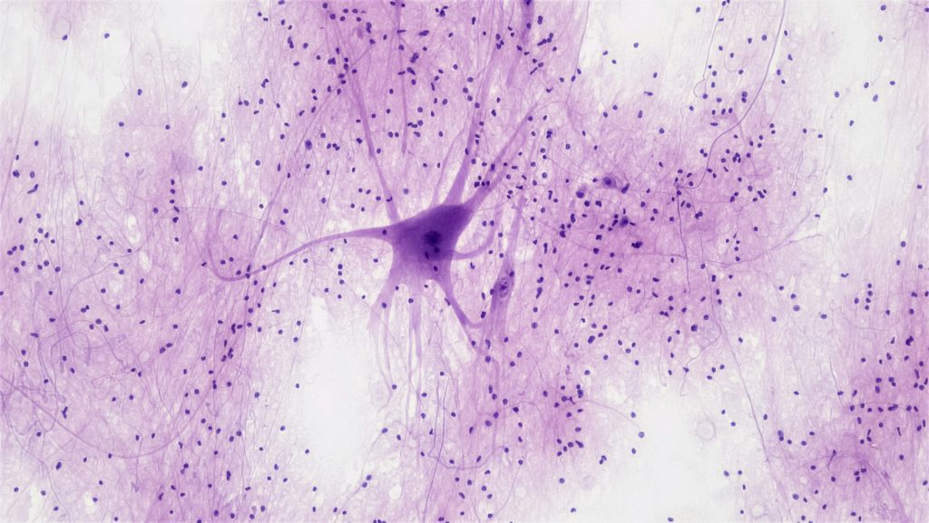 A picture of neurons