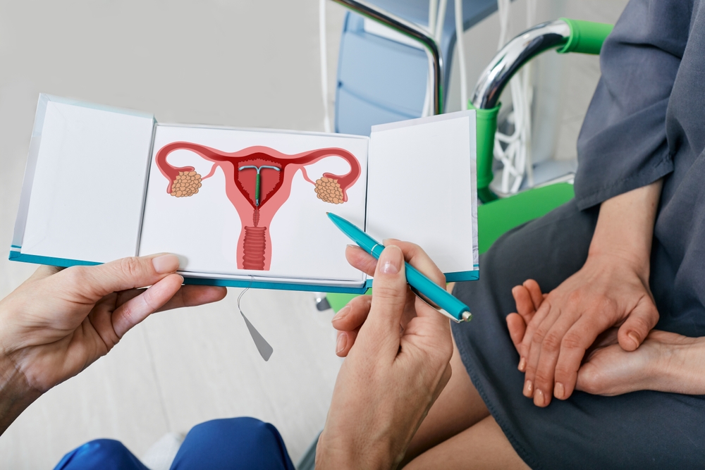 Gynecologist showing female patient Intrauterine contraceptive device